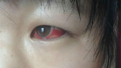 光觸媒除甲醛保護(hù)新裝修教室空氣，更保護(hù)孩子們